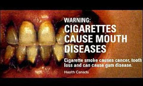 Oral hygiene vs Smoking cigarettes
